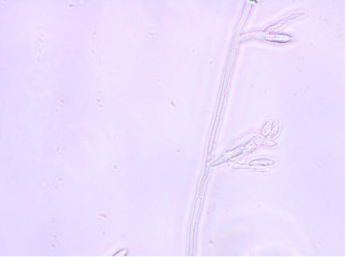 Monofialidy <i>F. graminearum</i>, powiększenie 400x