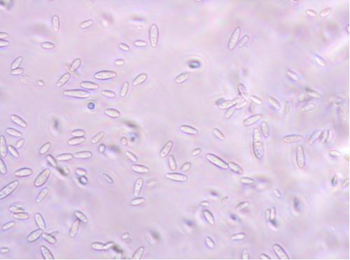 Zdj. 3. Mikrokonidia <i>F. oxysporum</i>, powiększenie 400x